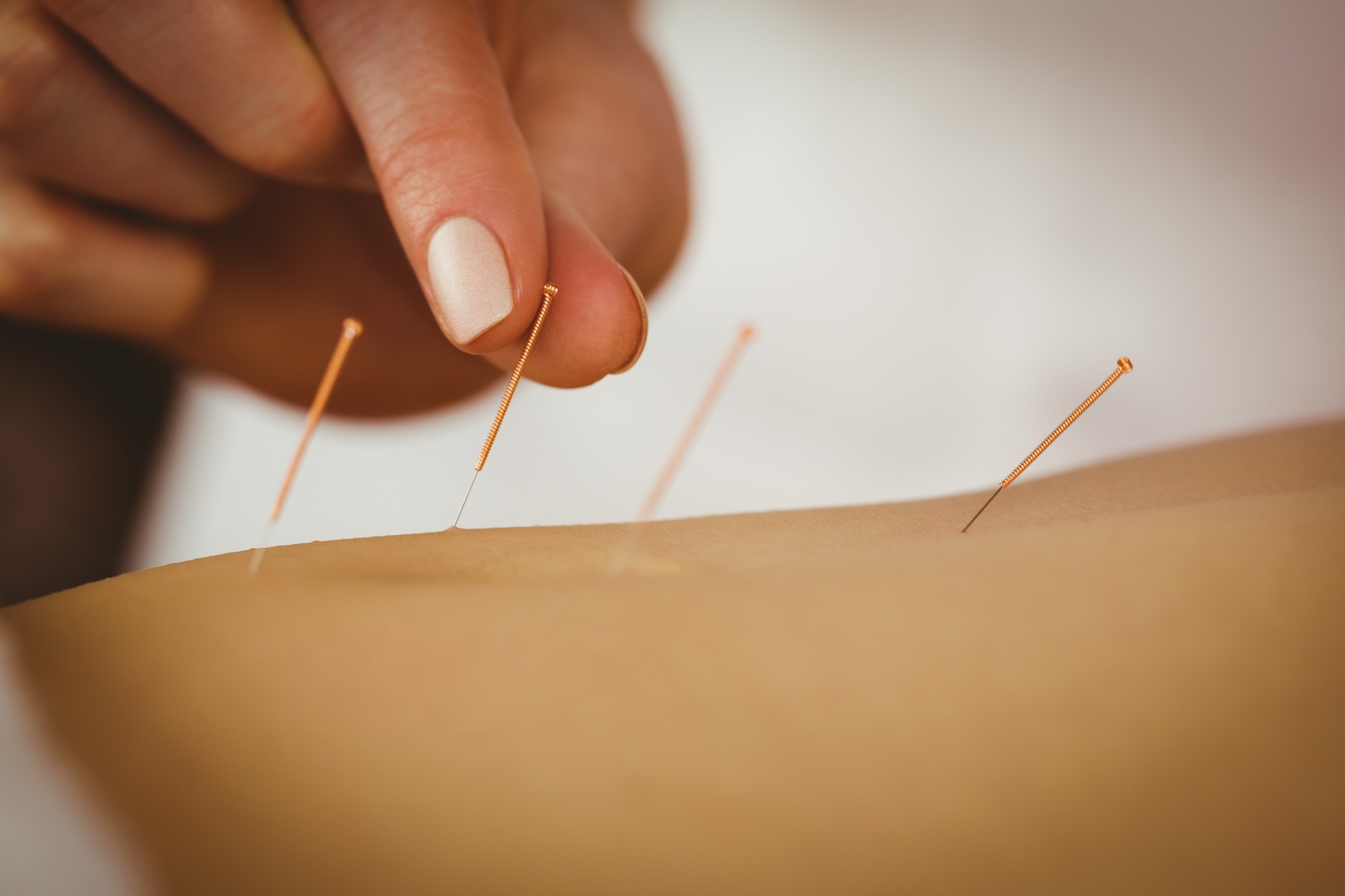 Kurs - Dry Needling Level 1